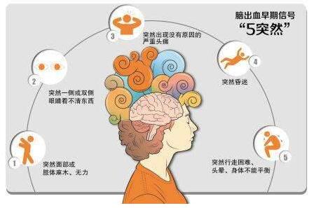 心腦血管病別等發(fā)作才篩查，經(jīng)顱多普勒TCD超聲檢測心腦血管